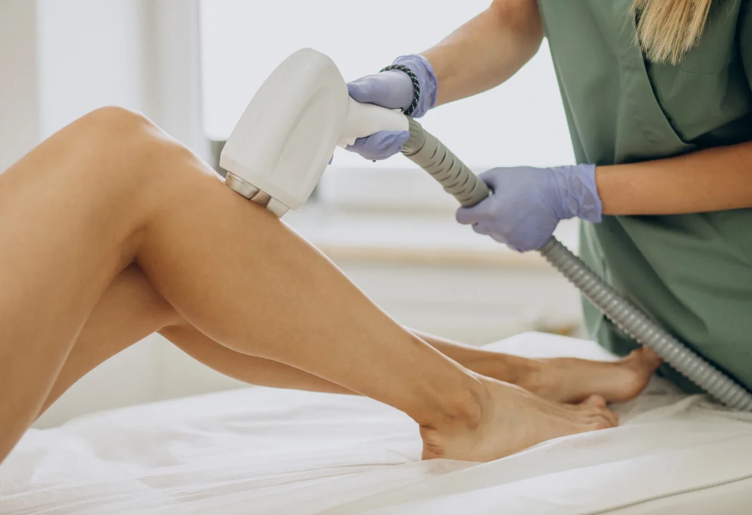 Laser hair removal treatment being carried out