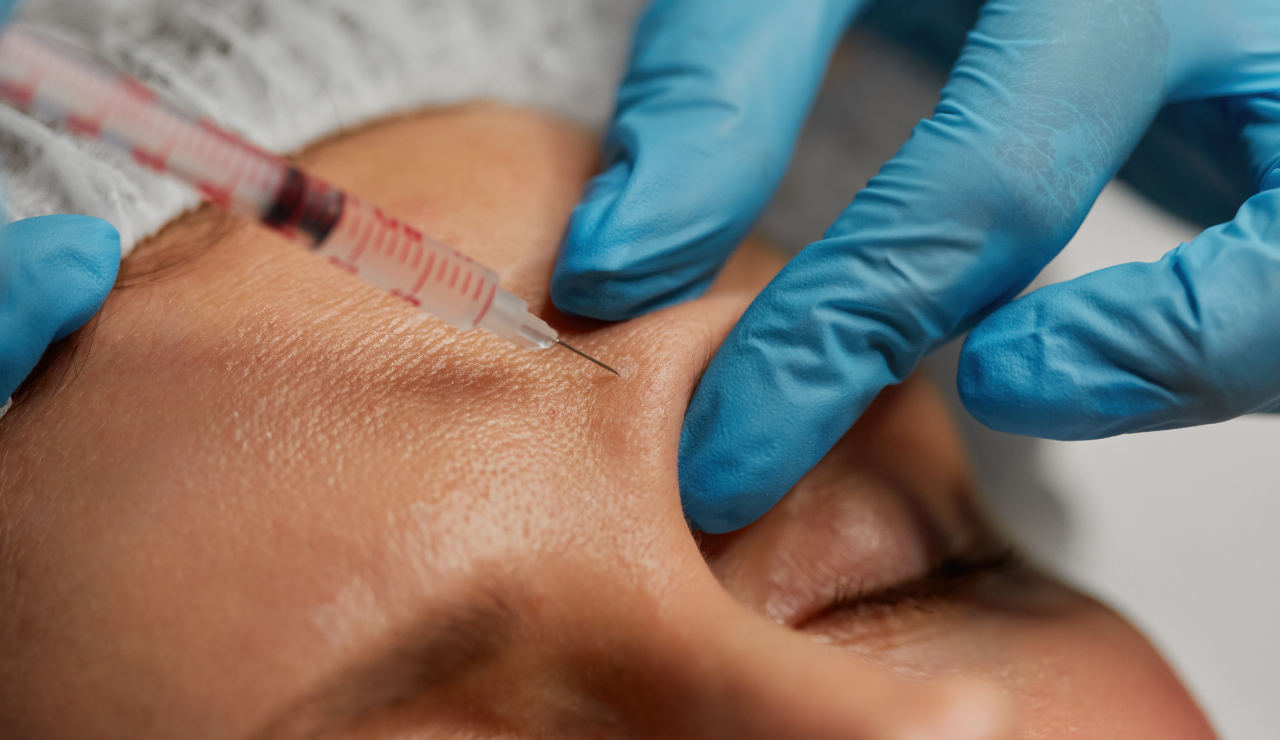 Botox Buckshaw Village Chorley 1