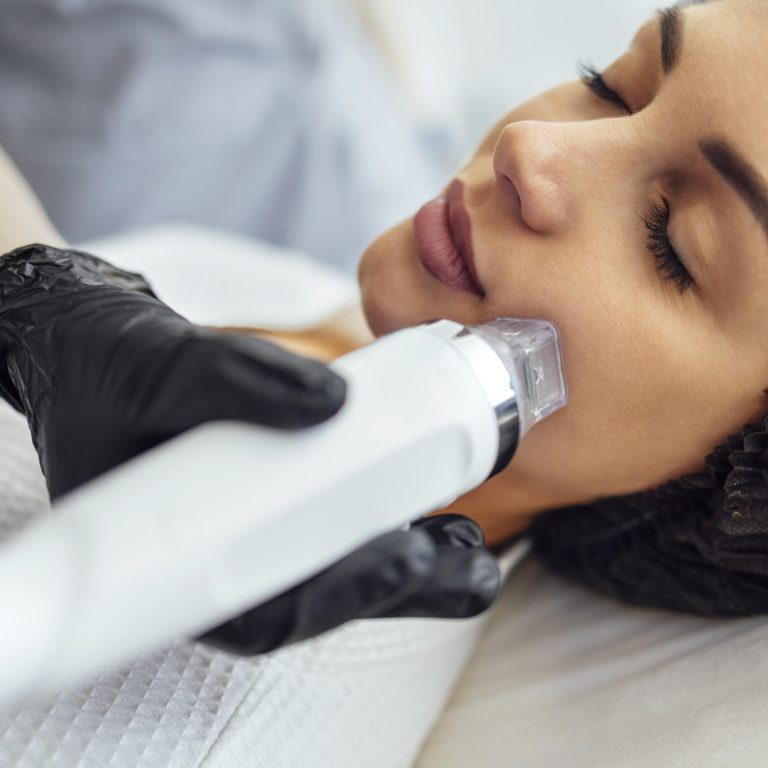 Microneedling Buckshaw Village Chorley Leyland Areas